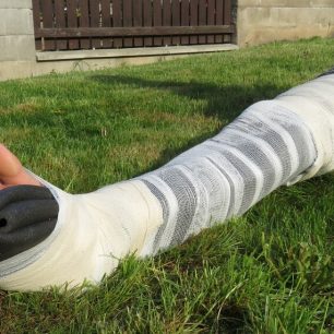 Dlaha dolní končetiny pomocí karimatky