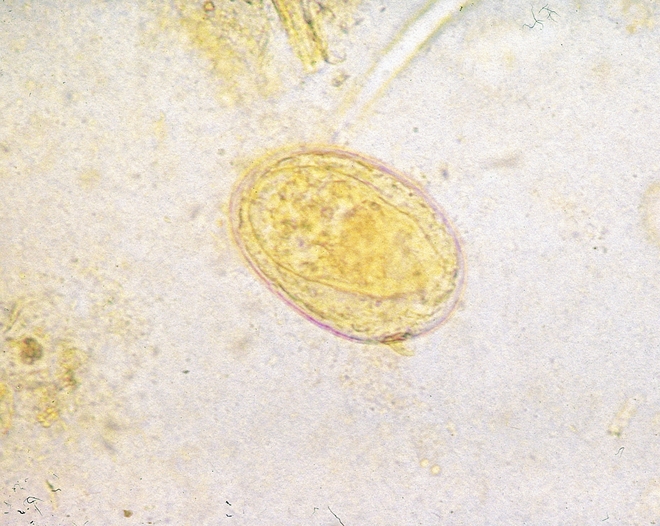 Napijete se živé vody? (PR)