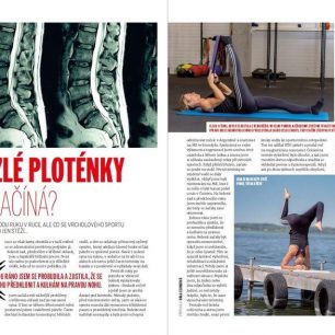 Nina Csonková bude radit jak na vyhřezlé meziobratlové ploténky