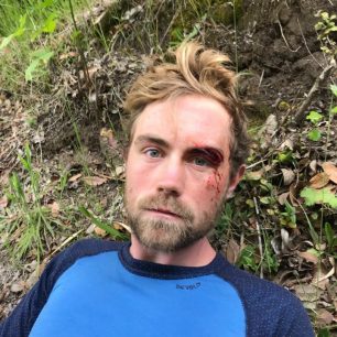 Espenovo roztržené obočí