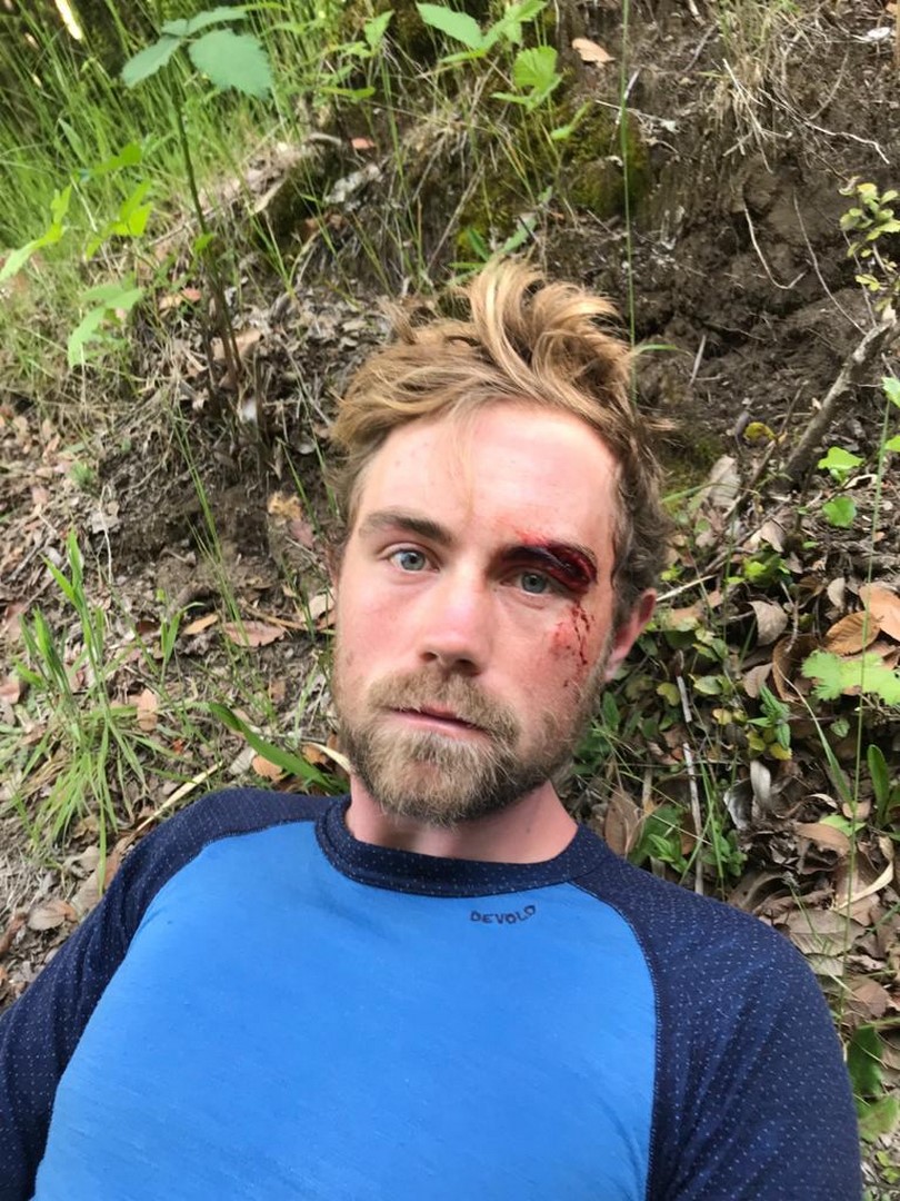 Espenovo roztržené obočí